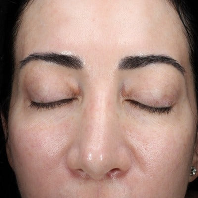 HA (Hyaluronic Acid) IMMERSE SerumTM
