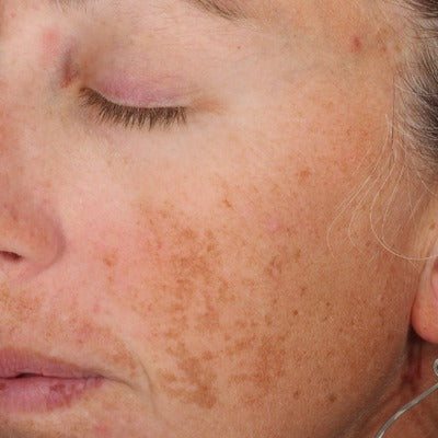 A-LUMINATE Brightening SerumTM