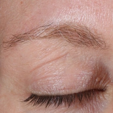 Restorative Eye Complex with TriHex Technology®