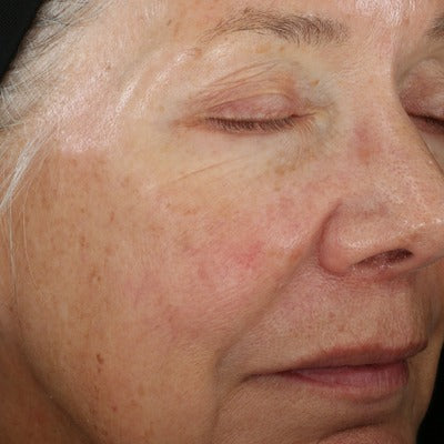 ReSURFACE Skin Polish