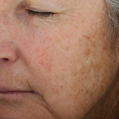 A-LUMINATE Brightening SerumTM