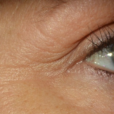 Restorative Eye Complex with TriHex Technology®