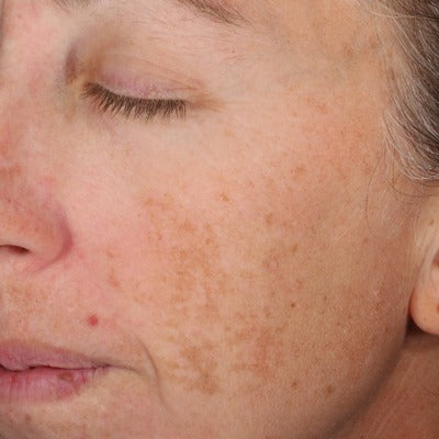 A-LUMINATE Brightening SerumTM