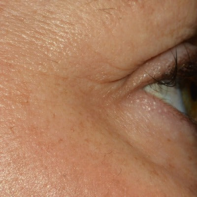 Restorative Eye Complex with TriHex Technology®