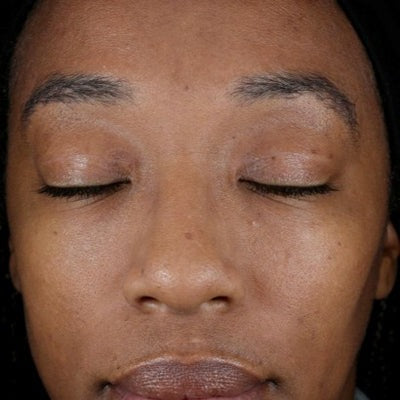 Renewal Retinol