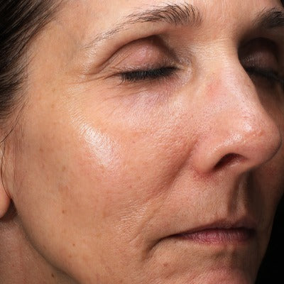 C-RADICAL Defense Antioxidant Serum