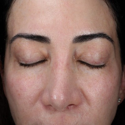 HA (Hyaluronic Acid) IMMERSE SerumTM