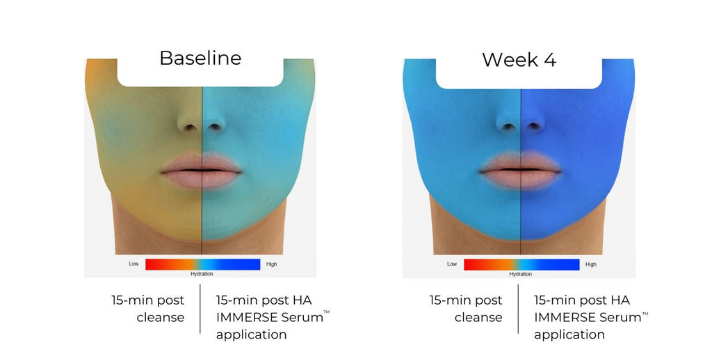HA (Hyaluronic Acid) IMMERSE SerumTM