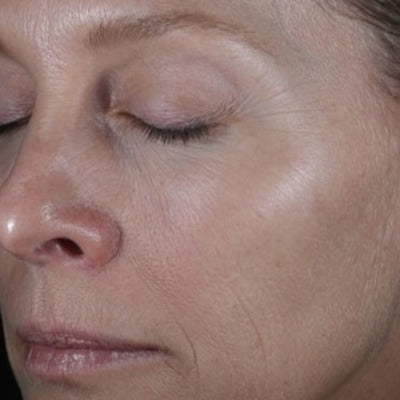 ReSURFACE Skin Polish