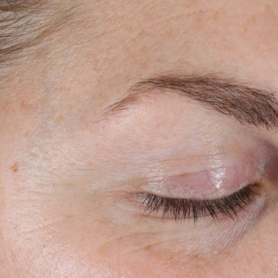 Renewal Retinol