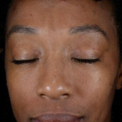 Renewal Retinol