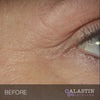 Restorative Eye Complex with TriHex Technology®