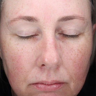 C-RADICAL Defense Antioxidant Serum