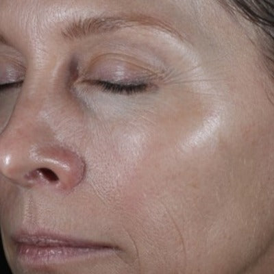ReSURFACE Skin Polish
