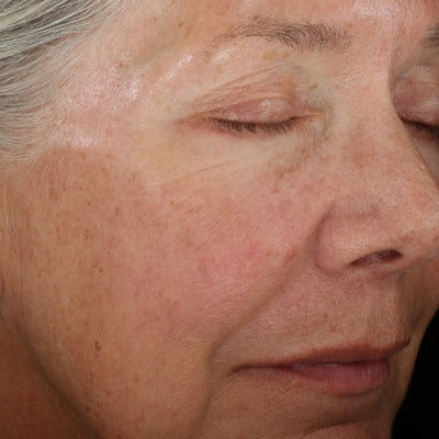 ReSURFACE Skin Polish