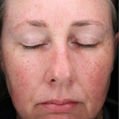C-RADICAL Defense Antioxidant Serum