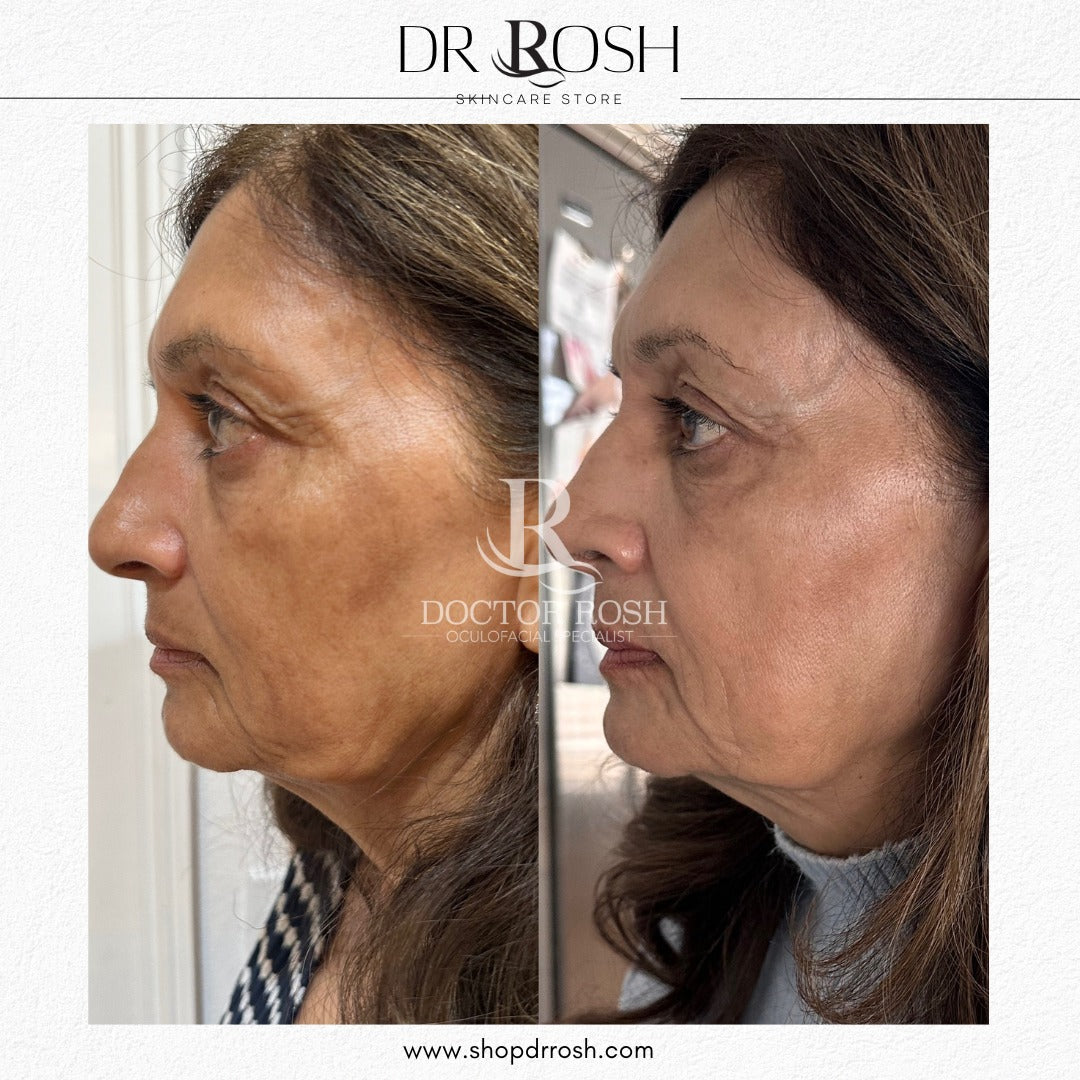 Signature Brightening Pads