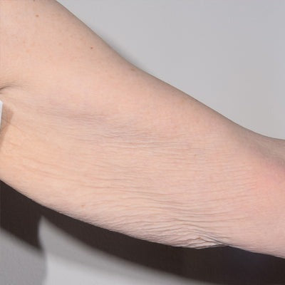 TransFORM Body Treatment with TriHex Technology®