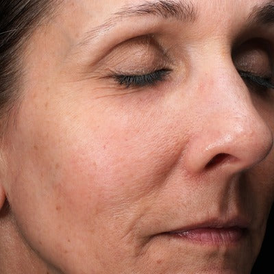 C-RADICAL Defense Antioxidant Serum