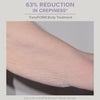 TransFORM Body Treatment with TriHex Technology®