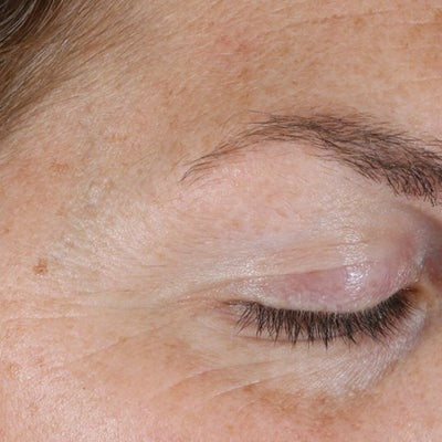 Renewal Retinol