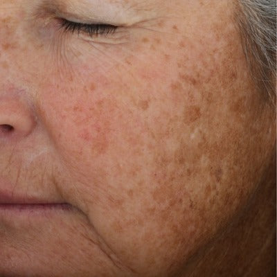 A-LUMINATE Brightening SerumTM