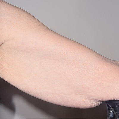 TransFORM Body Treatment with TriHex Technology®