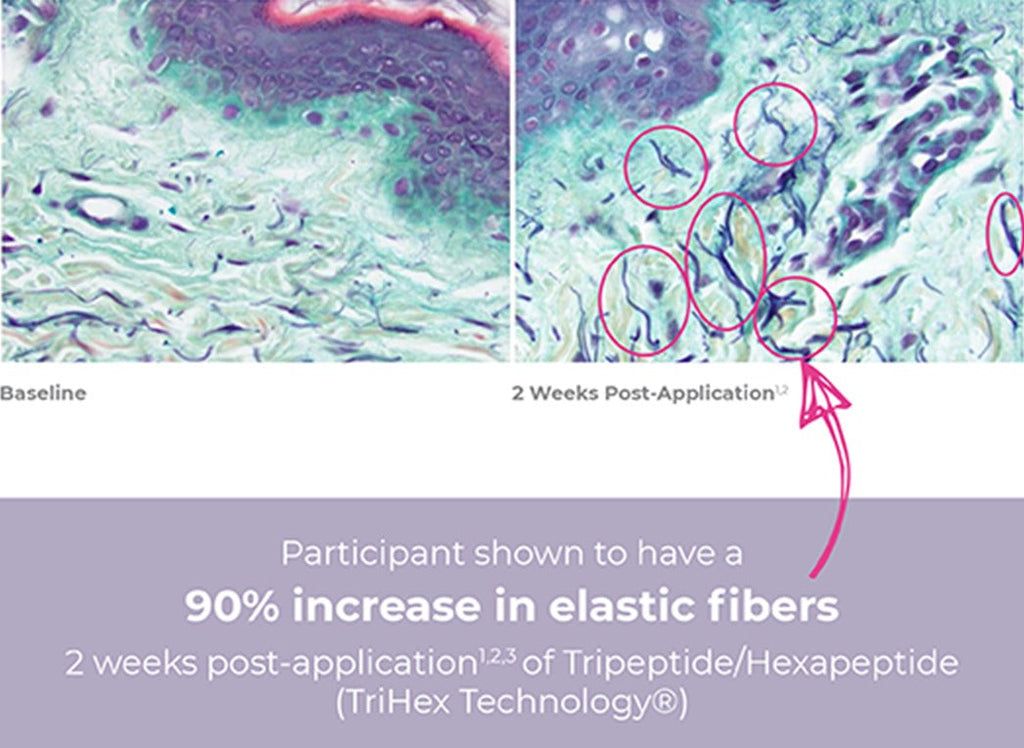 INhance Post-Injection Serum with TriHex Technology®